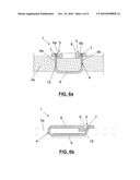  FIXATION DEVICE FOR THE FIXATION OF BONE FRAGMENTS diagram and image