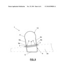  FIXATION DEVICE FOR THE FIXATION OF BONE FRAGMENTS diagram and image