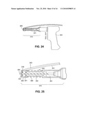 Autologous Bone Harvest During Osteotomy and Bone Drilling Procedures diagram and image