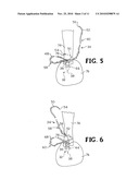 SUTURE WITH AN INTERMEDIATE BARBED BODY diagram and image