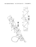 SUTURE WITH AN INTERMEDIATE BARBED BODY diagram and image