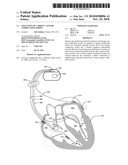 Selection of Cardiac Capture Verification Modes diagram and image