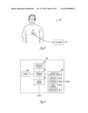 BAROREFLEX ACTIVATION FOR ARRHYTHMIA TREATMENT diagram and image