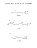 BAROREFLEX ACTIVATION FOR ARRHYTHMIA TREATMENT diagram and image