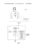 BAROREFLEX ACTIVATION FOR ARRHYTHMIA TREATMENT diagram and image