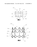 VASCULAR IMPLANT AND DELIVERY SYSTEM diagram and image