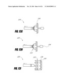 VASCULAR IMPLANT AND DELIVERY SYSTEM diagram and image