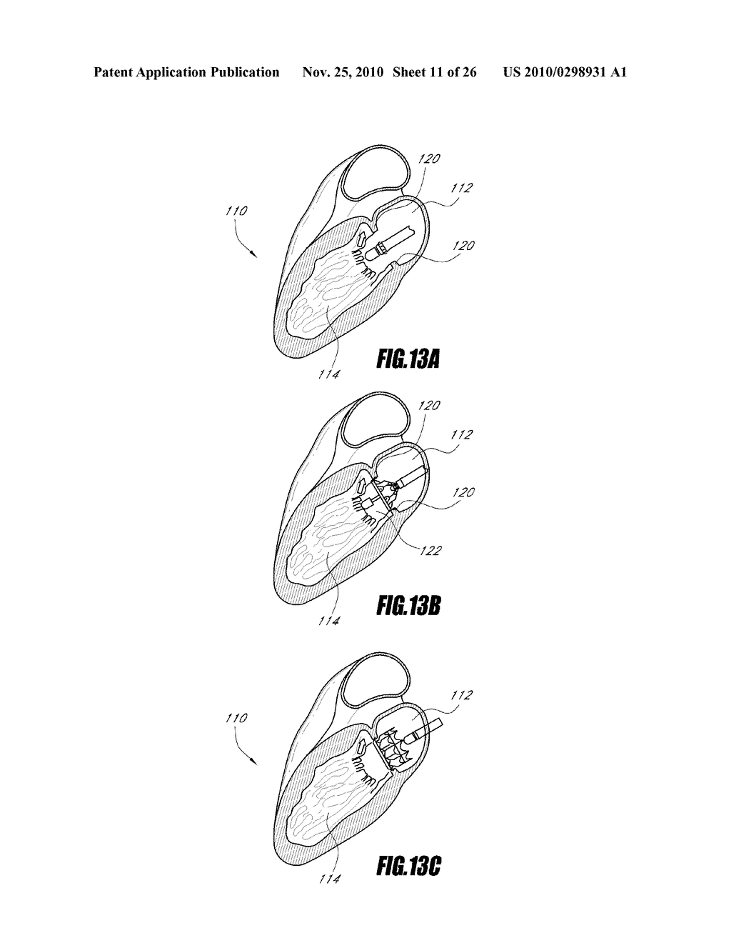 VASCULAR IMPLANT AND DELIVERY SYSTEM - diagram, schematic, and image 12