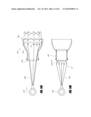 VASCULAR IMPLANT AND DELIVERY SYSTEM diagram and image