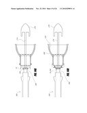 VASCULAR IMPLANT AND DELIVERY SYSTEM diagram and image