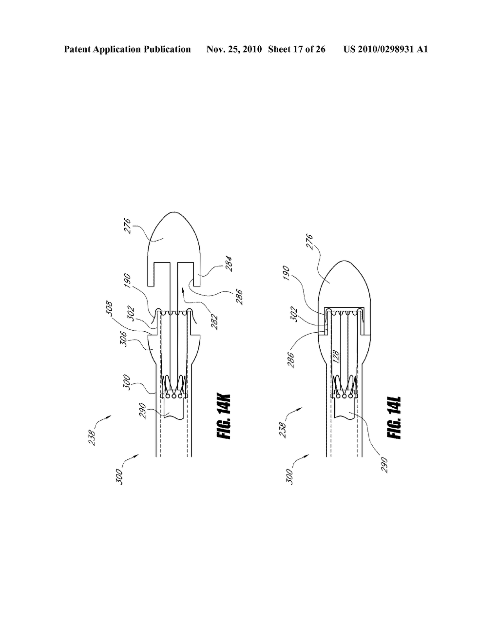 VASCULAR IMPLANT AND DELIVERY SYSTEM - diagram, schematic, and image 18