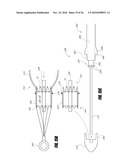 VASCULAR IMPLANT AND DELIVERY SYSTEM diagram and image