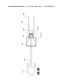 VASCULAR IMPLANT AND DELIVERY SYSTEM diagram and image