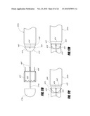 VASCULAR IMPLANT AND DELIVERY SYSTEM diagram and image