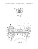 DUAL FUNCTION PACKING BRACKETS FOR TAPERED ARCHITECTURAL COLUMNS diagram and image