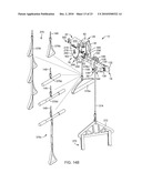 TRIM CONTROLLED, DYNAMICALLY CONTROLLABLE, TROLLEY BRAKE diagram and image