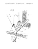 Watercraft Immobilizing System diagram and image