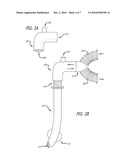 DETECTION AND SUPPRESSION OF AIRWAY / DRAPE FIRES DURING SURGICAL PROCEDURES diagram and image