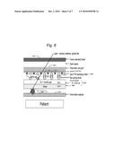 DETECTION AND SUPPRESSION OF AIRWAY / DRAPE FIRES DURING SURGICAL PROCEDURES diagram and image