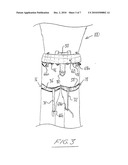 Single Waistband Belt System Convertible Between a Sit Harness and Quick Release Utility Belt diagram and image