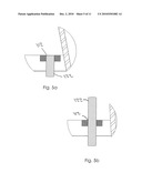 Securing Device diagram and image