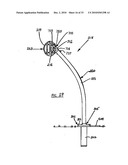 BARRIER diagram and image