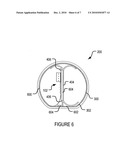 FLEXIBLE SHEET SENSOR INSERTED IN TUBE diagram and image