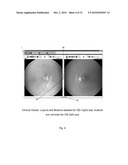 METHOD AND SYSTEM FOR RETINAL HEALTH MANAGEMENT diagram and image