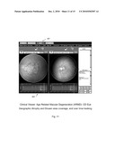 METHOD AND SYSTEM FOR RETINAL HEALTH MANAGEMENT diagram and image