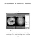 METHOD AND SYSTEM FOR RETINAL HEALTH MANAGEMENT diagram and image