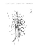 LOUPE SUPPORT SYSTEM diagram and image