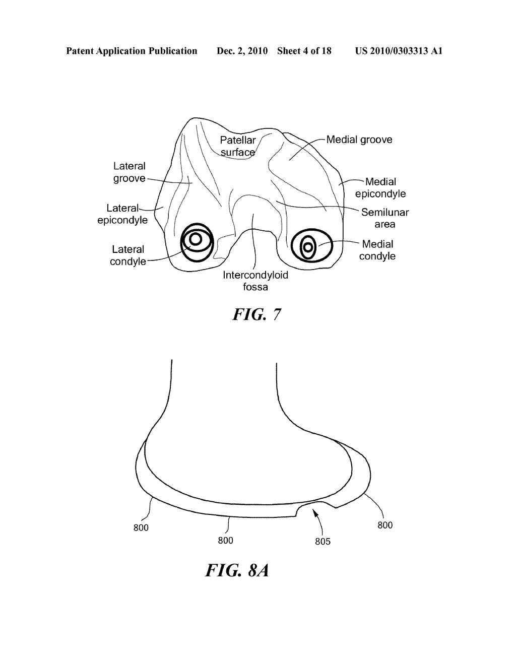 Methods and Compositions for Articular Repair - diagram, schematic, and image 05