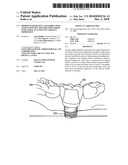 Mehod of designing and fabricating patient-specific restorations from intra-oral scanning of a digital impression diagram and image