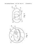 PET LOCAL TOMOGRAPHY diagram and image