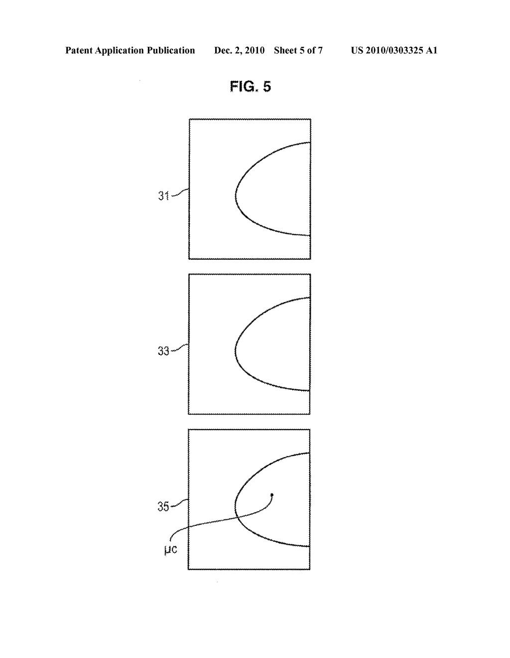 METHOD, SYSTEM AND COMPUTER PROGRAM PRODUCT TO PROCESS A SET OF TOMOSYNTHESIS SLICES - diagram, schematic, and image 06