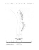 Erosion control Islands in high bank stream remediation diagram and image