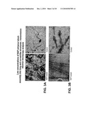 NOVEL THERAPEUTICS BASED ON TAU/MICROTUBULE DYNAMICS diagram and image