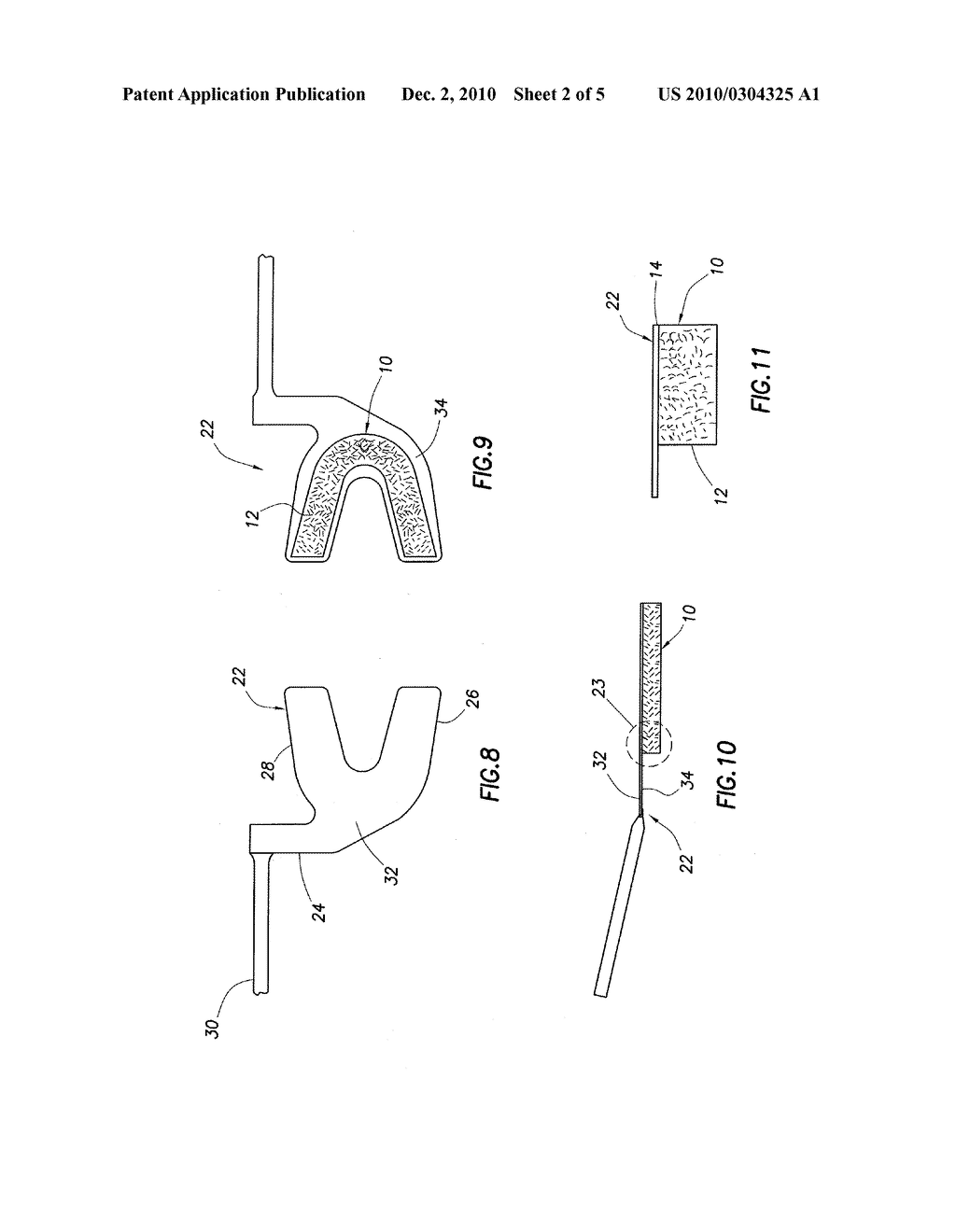 Elastically Deformable Bite Fork Stabilizer and Associated Methods - diagram, schematic, and image 03