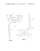 Elastically Deformable Bite Fork Stabilizer and Associated Methods diagram and image