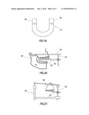 Elastically Deformable Bite Fork Stabilizer and Associated Methods diagram and image