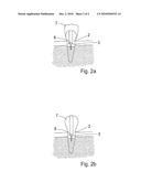 DENTAL SUPERSTRUCTURE, AND A METHOD OF MANUFACTURE THEREOF diagram and image