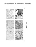 METHODS AND COMPOSITIONS FOR HOMOLOGOUS RECOMBINATION IN HUMAN CELLS diagram and image