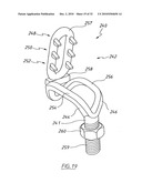 Apparatus for shucking oysters diagram and image