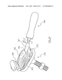 Apparatus for shucking oysters diagram and image