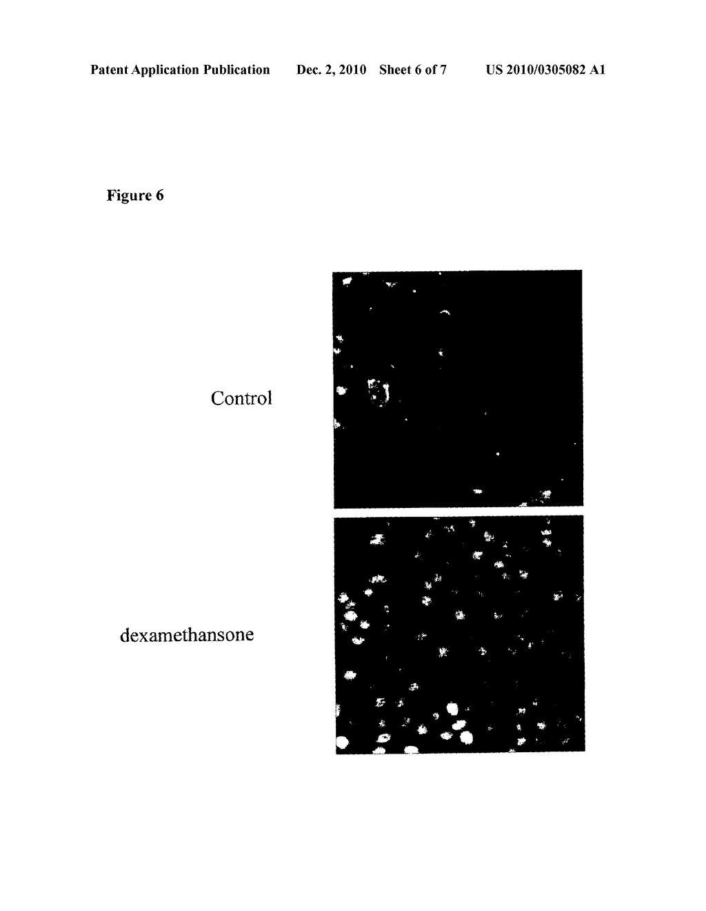 Use of FKBPL gene to identify a cause of infertility - diagram, schematic, and image 07