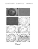 PHARMACEUTICAL COMPOSITION FOR PREVENTING, STABILISING AND/OR INHIBITING BLOOD AND LYMPH VASCULARIZATION diagram and image