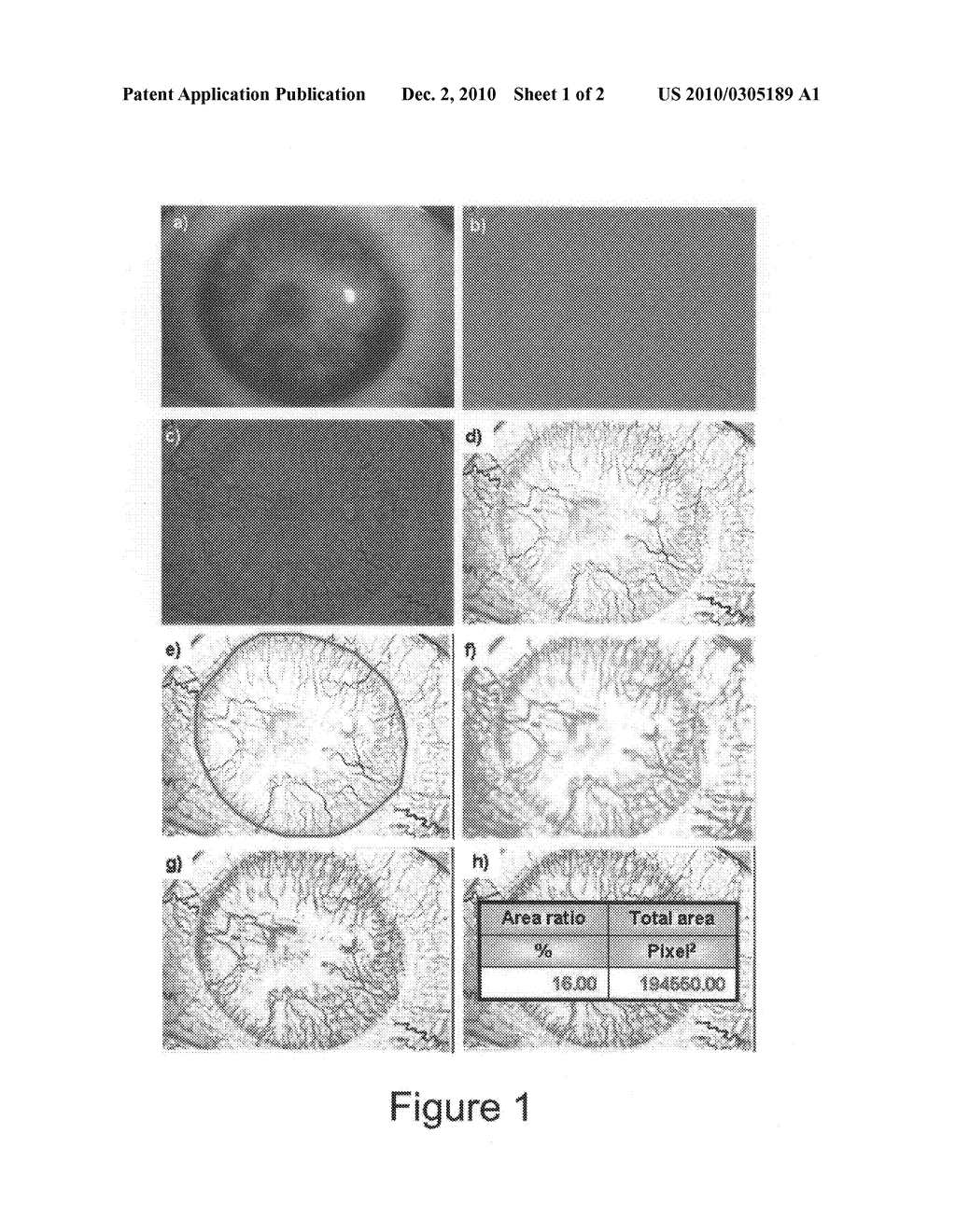 PHARMACEUTICAL COMPOSITION FOR PREVENTING, STABILISING AND/OR INHIBITING BLOOD AND LYMPH VASCULARIZATION - diagram, schematic, and image 02