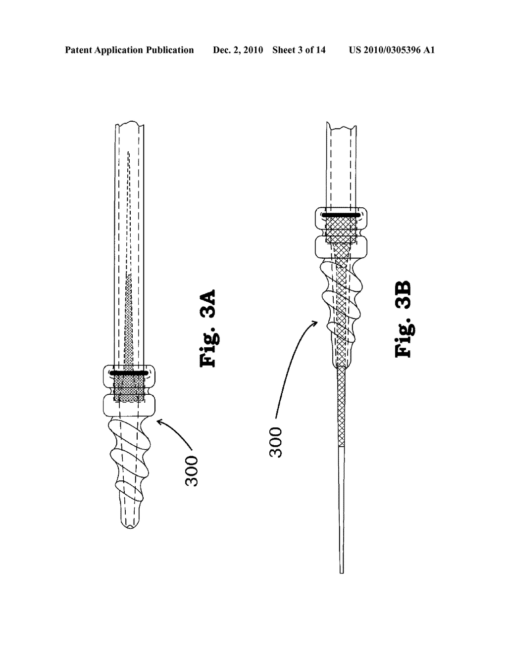 METHOD AND APPARATUS FOR CREATING A PATHWAY IN AN ANIMAL - diagram, schematic, and image 04