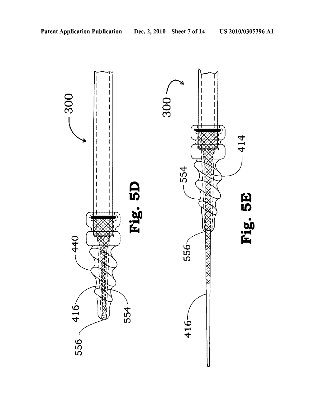 METHOD AND APPARATUS FOR CREATING A PATHWAY IN AN ANIMAL - diagram, schematic, and image 08