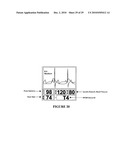 Device and system for wireless monitoring of the vital signs of patients diagram and image